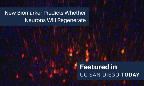 New-Biomarker-Predicts-Whether-Neurons-Will-Regenerate.png